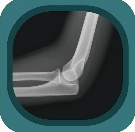 x ray elbow anatomy icon